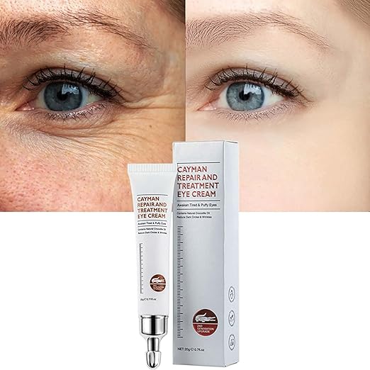 Anti-Aging Eye Cream Eye Cream, 28 Seconds to Remove Under Eye Bags Wrinkles Puffiness Dark Circles and Fine Lines